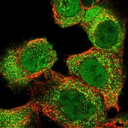 SLC22A23 Antibody, Novus Biologicals 0.1mL; Unlabeled:Antibodies, Polyclonal